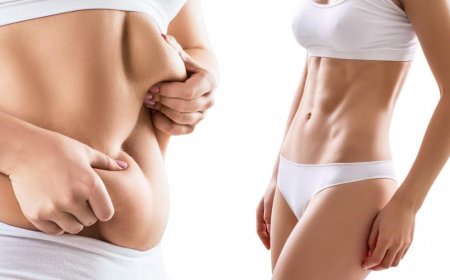 Revolutionizing Liposuction How Best Surgeons in Dubai Use Advanced Techniques