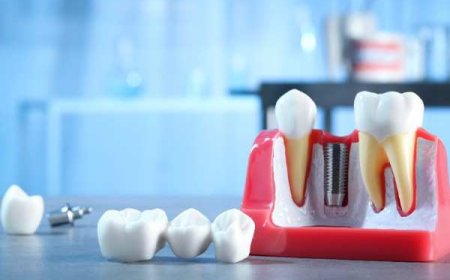 Personalised Support for Healthier Smiles in East Grinstead