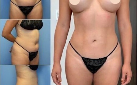 Sculpt Your Dream Body with Best Doctors in Dubai for Body Contouring