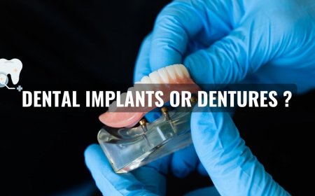 Dental Implants vs. Dentures: What’s the Better Option Near You?