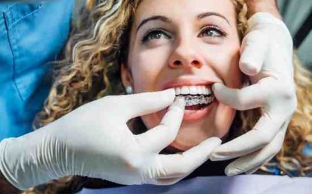 Busy Lifestyle? Here’s Why Invisalign Works for You